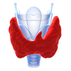 Hashimoto's Thyroiditis